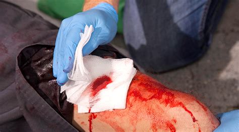 May Is Stop The Bleed Month Ems Safety Services Inc