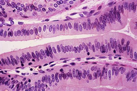 simple columnar epithelium lm stock image  science