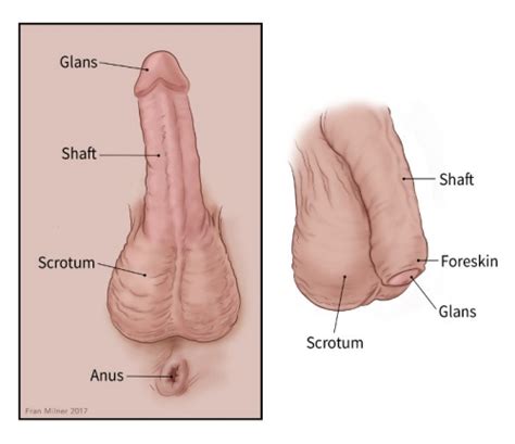 What Is Penile Cancer