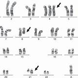 Karyotype Xy Banded Q22 sketch template