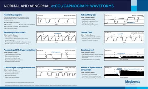 normal  abnormal capnography waveforms infographic capnoacademy capnoacademy