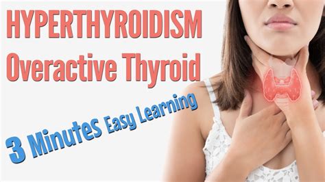 hyperthyroidism overactive thyroid  symptoms risk factors