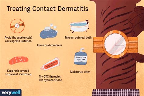 contact dermatitis  treated