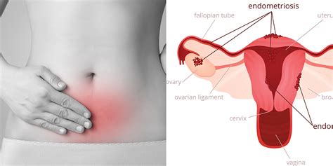 Pain In Your Abdomen During Sex Stomach Pain Belly Pain
