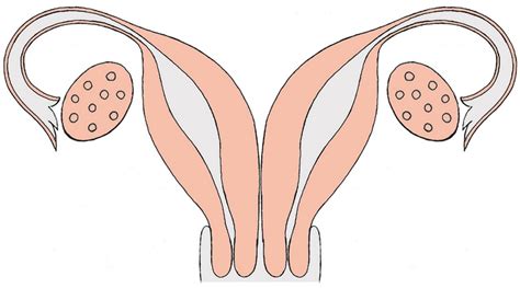 Double Uterus Symptoms Treatment And Characteristics