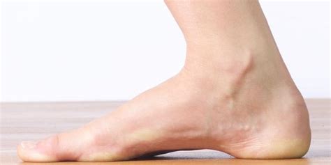 High Arches Problems How To Relieve Foot Arch Pain