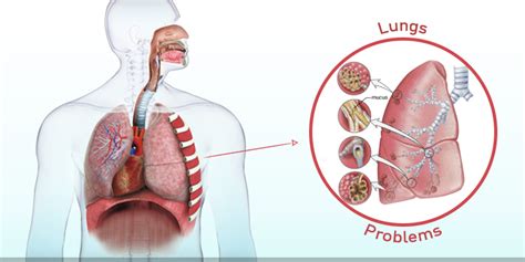 love  lungs beware   air   breathing kent blog