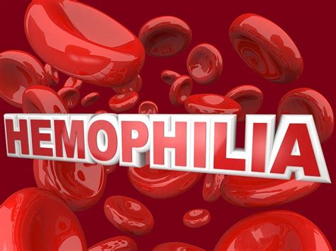 fda approves idelvion  hemophilia