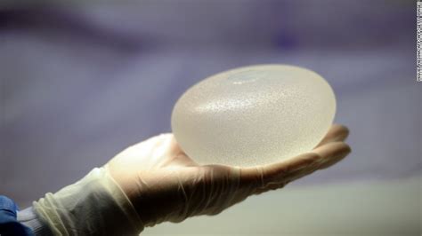 Fda Reports Additional Cases Of Cancer Linked To Breast Implants Cnn
