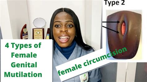 4 types of female genital mutilation you should know youtube