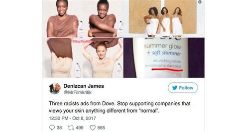 Black Model In ‘racist’ Dove Ad Says It Was ‘misinterpreted’ Miami Herald