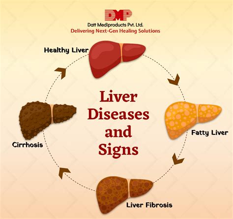 liver diseases signs blog  datt mediproducts