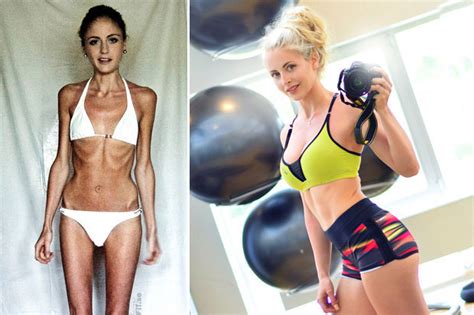 Anorexia Nervosa Sufferer Beats Eating Disorder To Become Weightlifting