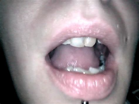 Endoscope Throat Footage 0 Xlittle Secretsx1 Clips4sale