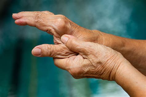 rheumatoid arthritis treatment  san diego ca  pain center