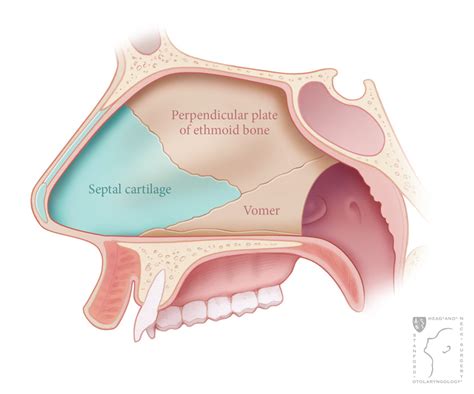 formation  nasal septum diagram septoplasty stanford health care