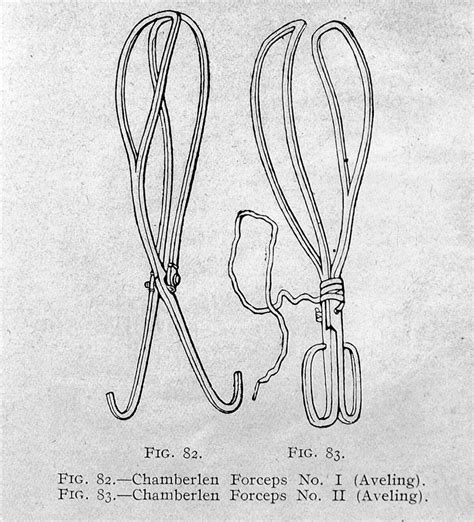 grip   history  forceps  medicine