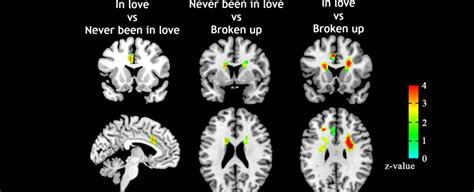 scientists can now tell if you re in love by scanning your brain