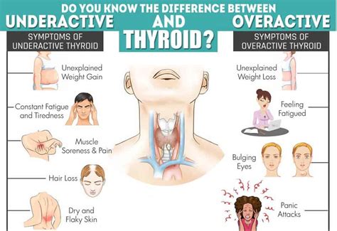 thyroid and weight loss can thyroid problems promote weight loss