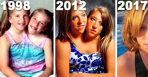 abby and brittany hensel conjoined twins where are they now rewaevo