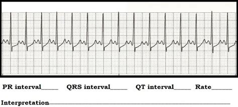 Float Nurse Ecg Rhythm Strip Quiz 89 Interval Measurements