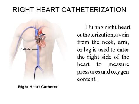cardiac catheterization presented by rajesh b m sc