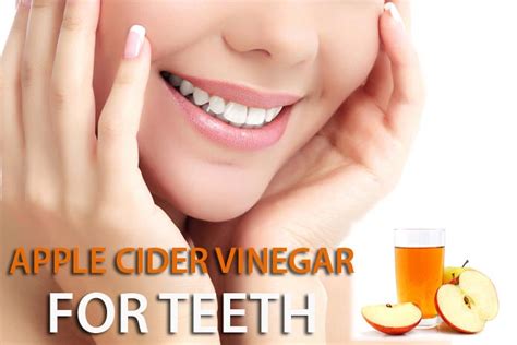 how to use apple cider vinegar for teeth whitening wikiyeah