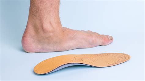 flat feet  symptoms treatment foot ankle group