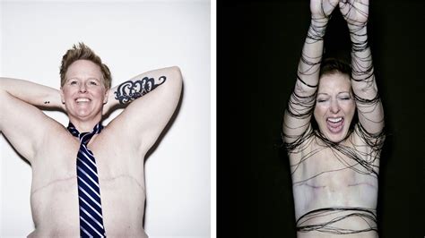 The Women Who Showed Their Breast Cancer Scars The New York Times