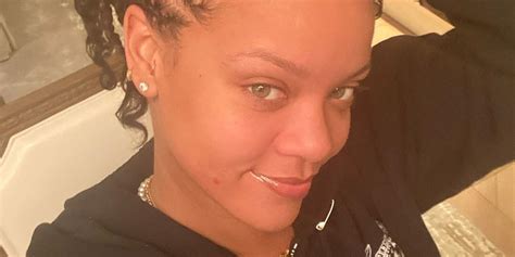 rihanna responds to fan who wants to pop pimple in no makeup photo