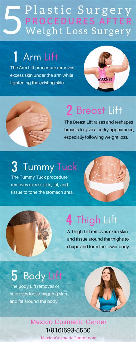 plastic surgery procedures  weight loss surgery infographic