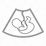 Womb Baby Drawing Outline Getdrawings sketch template