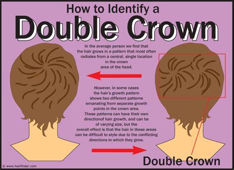 problem   double crown hair hairstyle