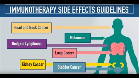 Immunotherapy Side Effects Guidelines Youtube
