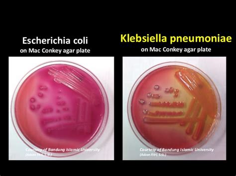 escherichia coli and klebsiella pneumoniae unisba indonesia