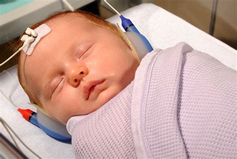 years  newborn hearing screening data phe screening