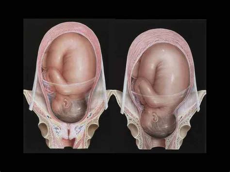 the contracting power of the uterus — nova birth services llc