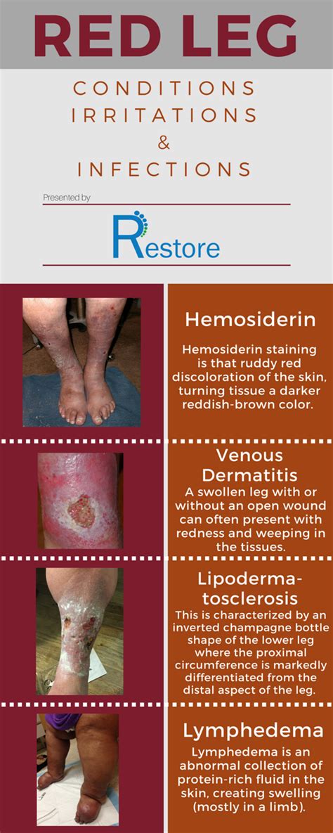 red leg  innovative wound healing transcu  eo concepts