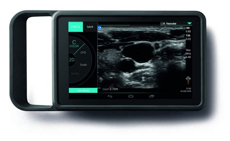 sonosite iviz ob gyn ultrasound machine  sale  strata imaging