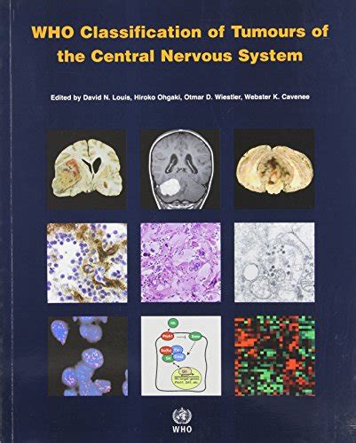 Epub⋙ Who Classification Of Tumours Of The Central Nervous System