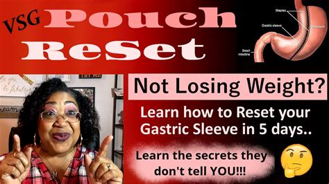 How To Shrink Your Stomach Reset Your Gastric Sleeve Pouchreset