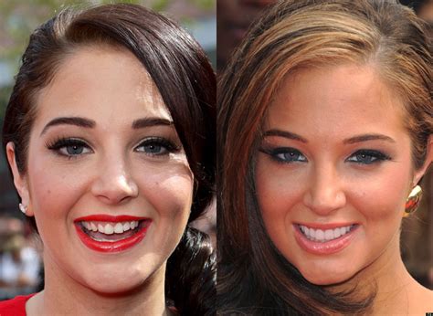 celebrity teeth    stars whove  dental work