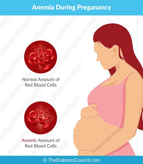 anemia in pregnant women group