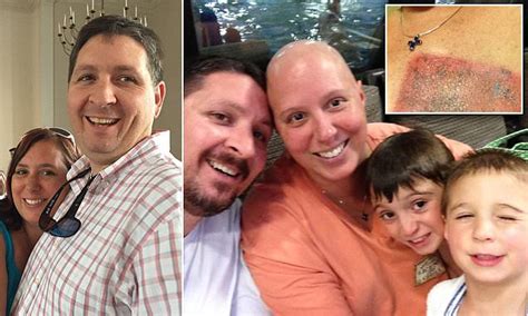 mother s weird freckles turn out to be rare breast cancer daily mail online