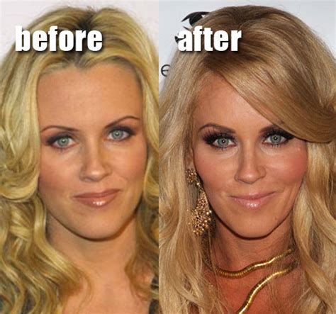 funny pictures    plastic surgery plastic surgery