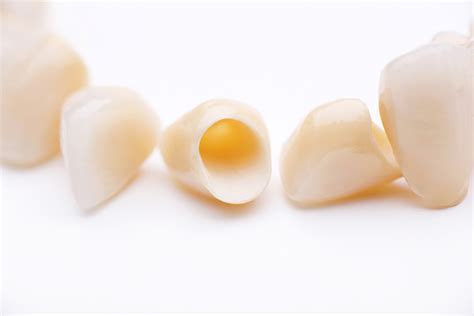 experience  benefits   ceramic crowns  dental health resource