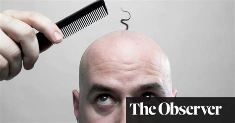 How Close Is A Cure For Baldness Fashion The Guardian