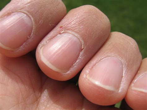 signs you have healthy nails insider
