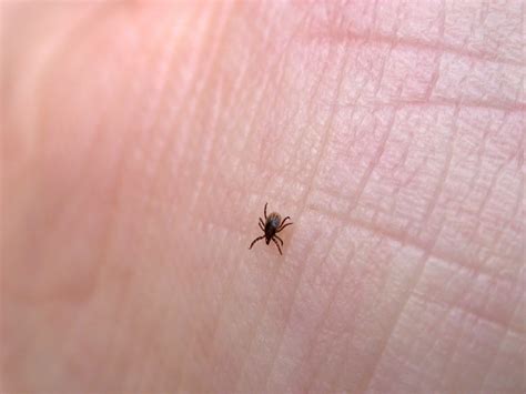 prevent tick bites   ticks wont   readers digest