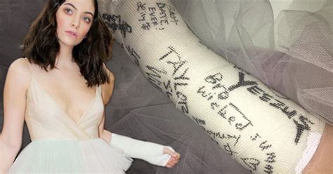 lorde got her cast signed by all the celebrities at the met gala 2016